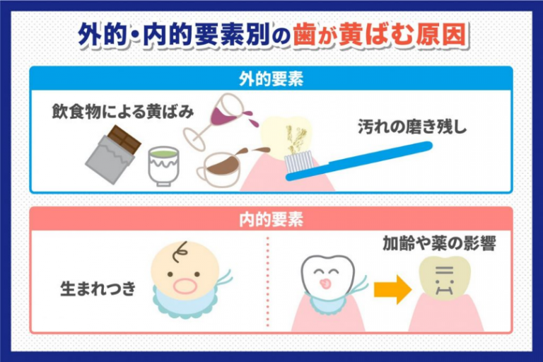 歯が黄色くなるのはなぜ？ | お口の学校